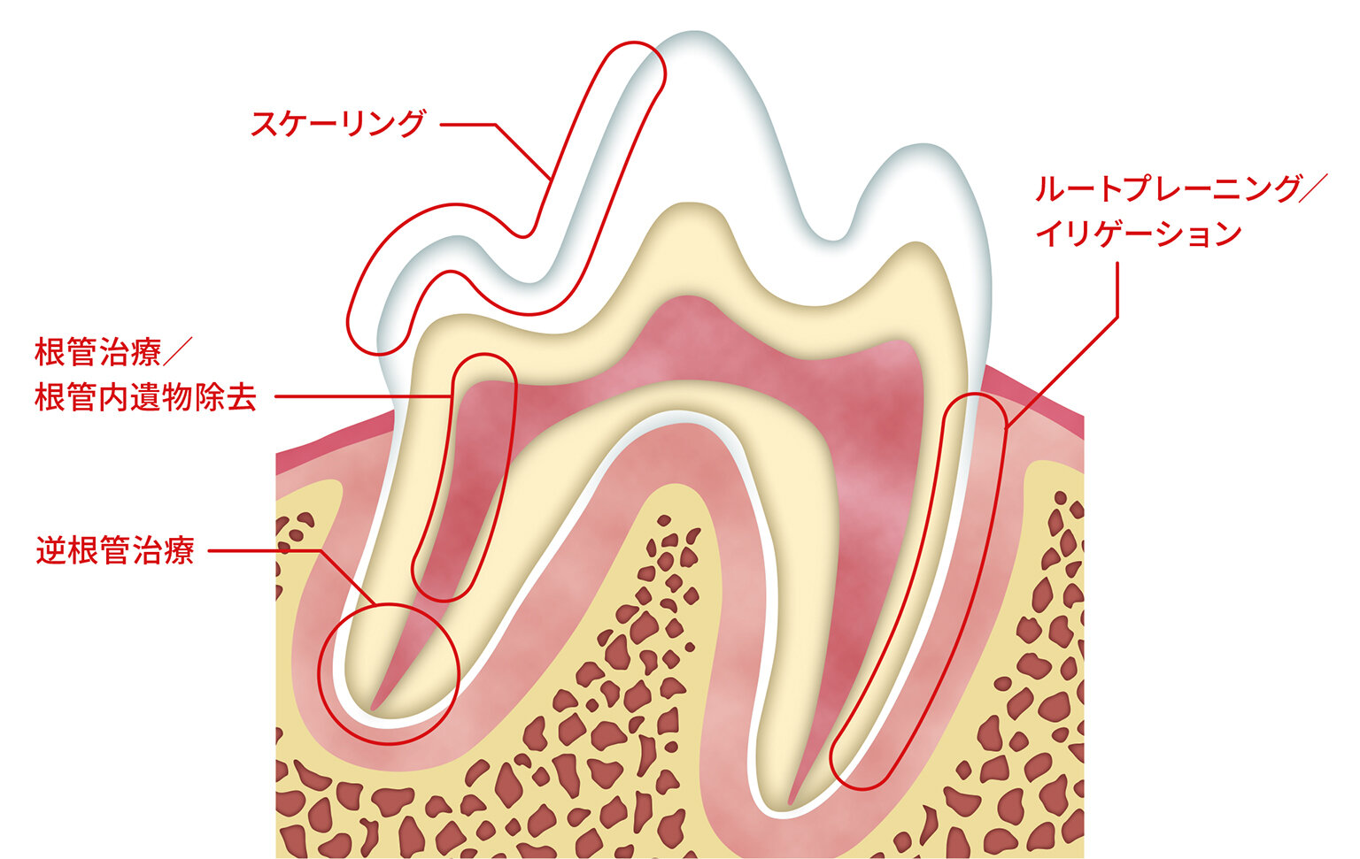 enac_tip_fig.jpg